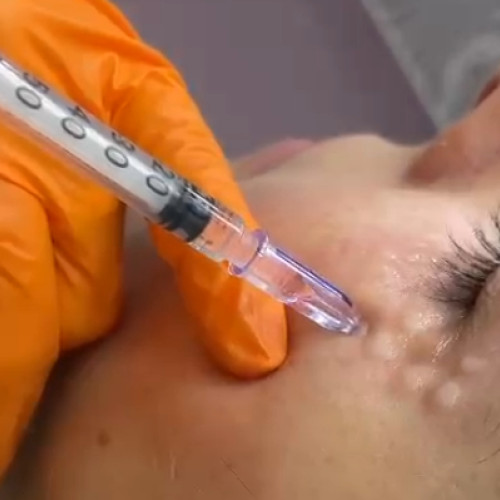 Conducere cercetată pentru injectări clandestine cu botox și acid hialuronic în două clinici din Craiova